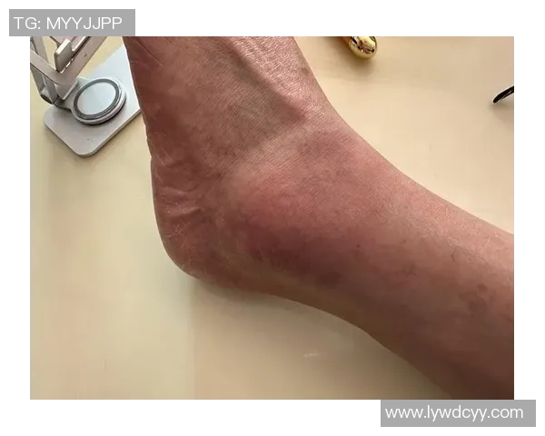 足球球星护踝装备解析 如何选择适合自己的护踝保护装备 足球球星护踝装备解析 如何选择适合自己的护踝保护装备